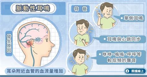 聽到水流聲|神經外科醫師圖文解說：吵到睡不著！「脈動性耳鳴」。